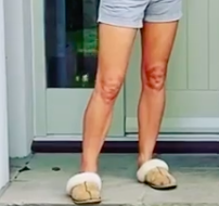amanda holden knee
