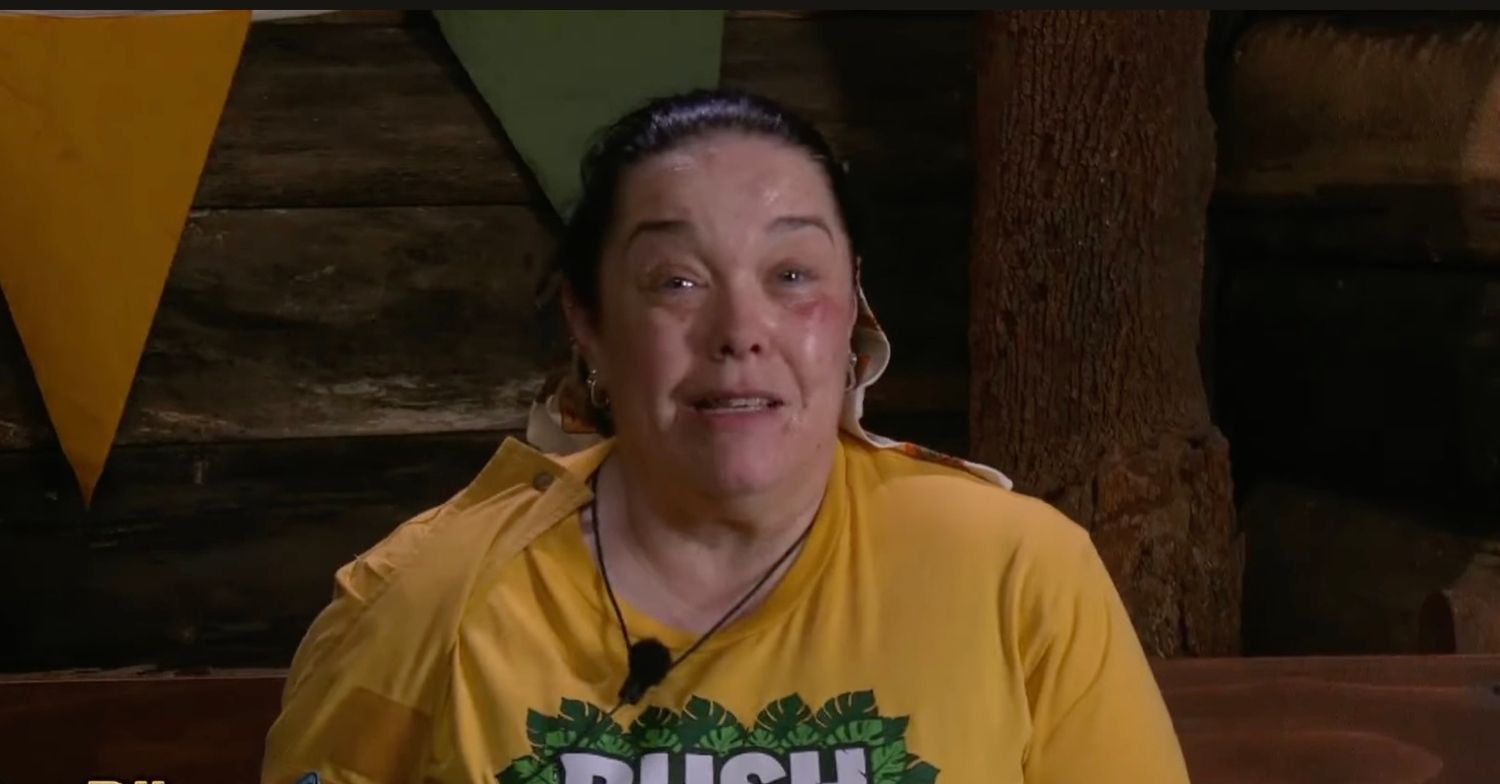 I'm A Celebrity viewers express concerns for Lisa Riley following swollen appearance
