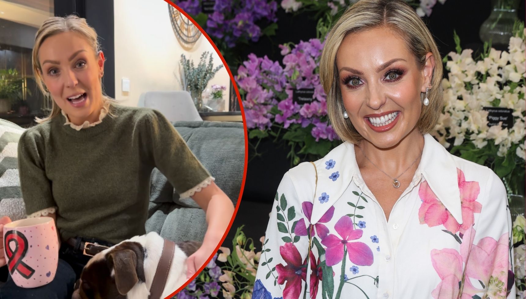 Amy Dowden announces she's having second mastectomy: 'This is not to treat a new cancer diagnosis'