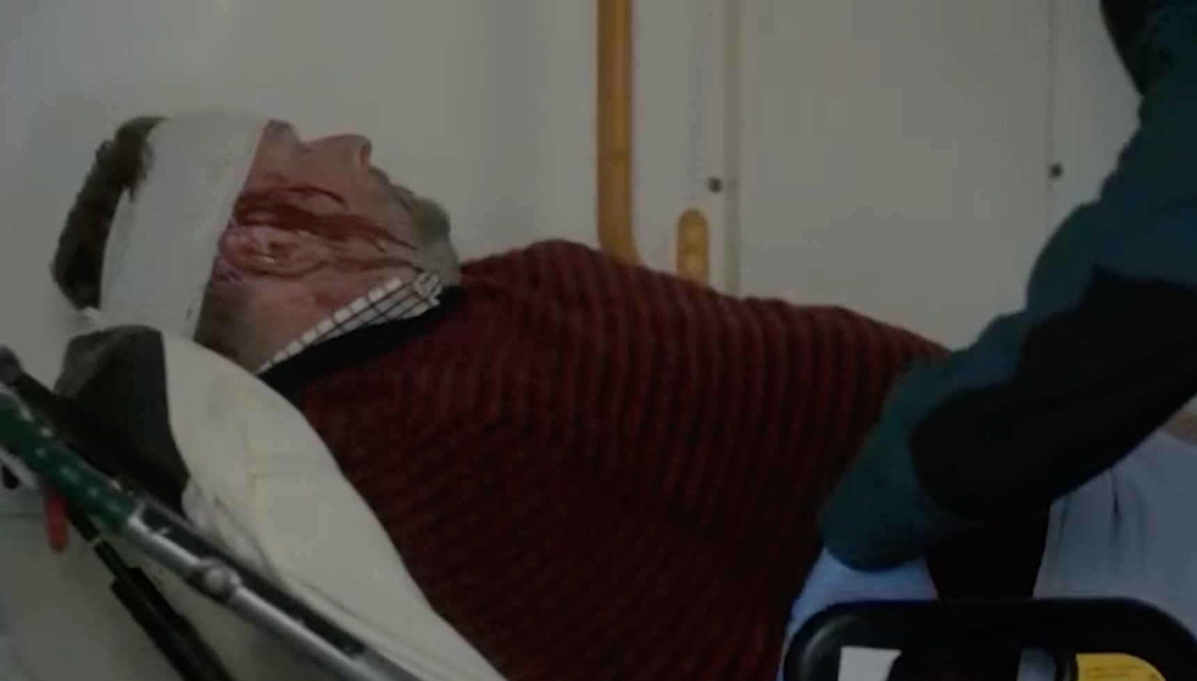 Colin Waite with bleeding head in Shetland