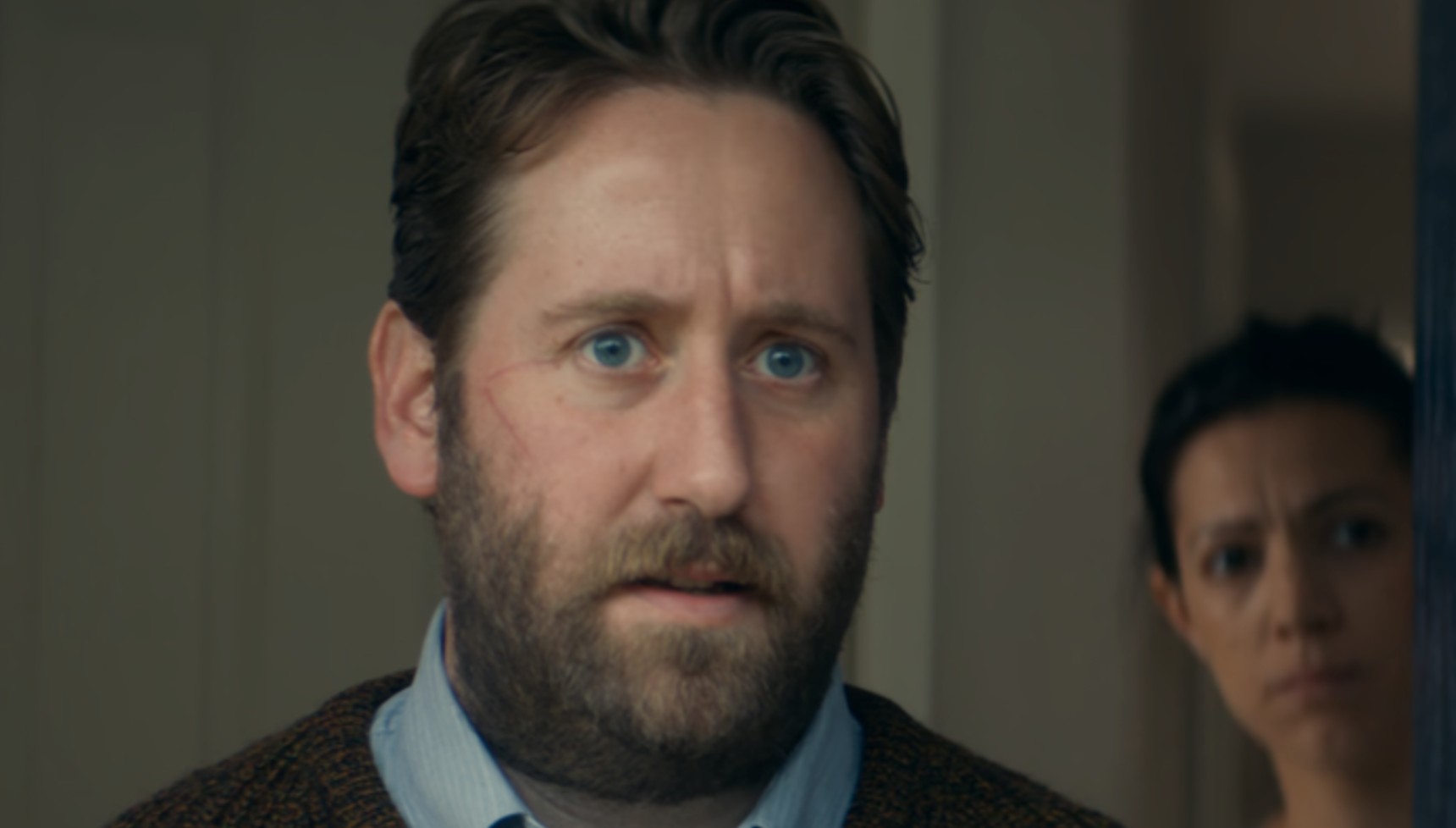 Jim Howick with a scar on his face in Broadchurch