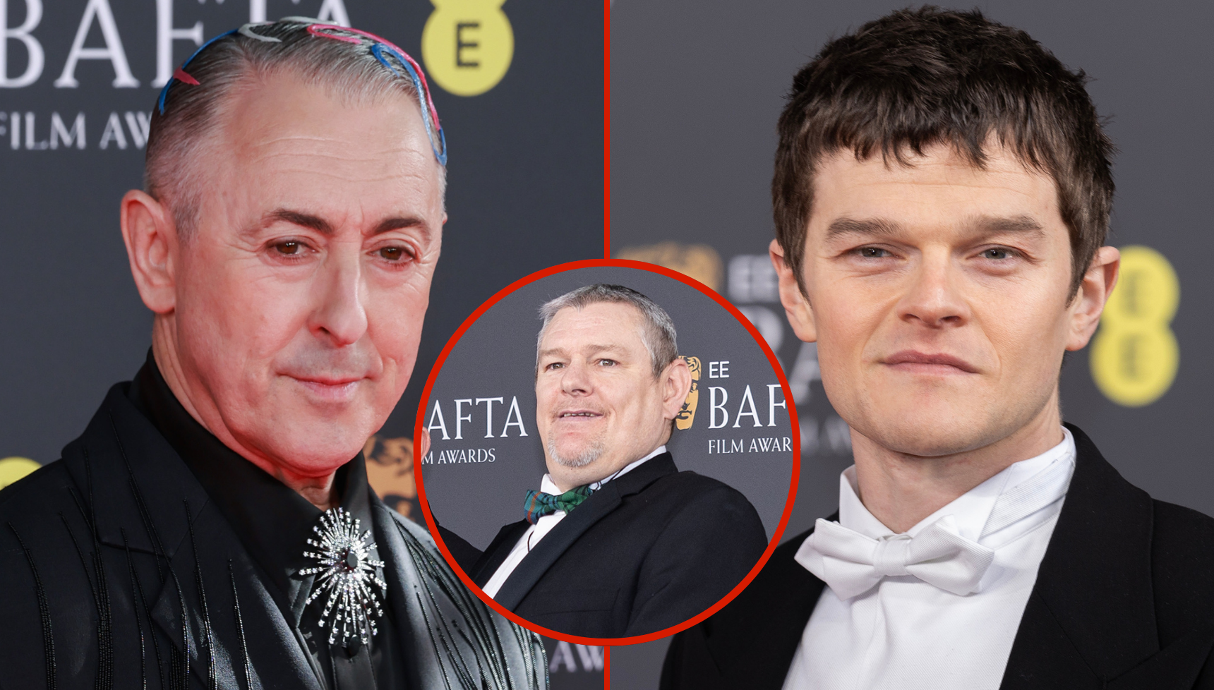 BBC shares statement over BAFTAs racial slur as Robert Aramayo breaks silence: 'It's not being abusive, it's Tourette's'