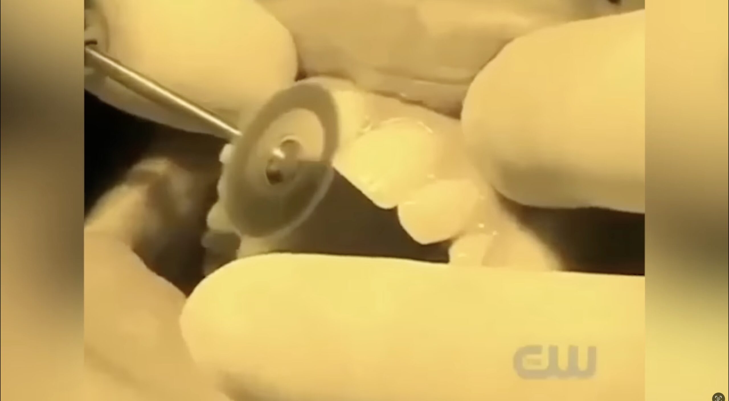 Chelsey at the dentist on ANTM