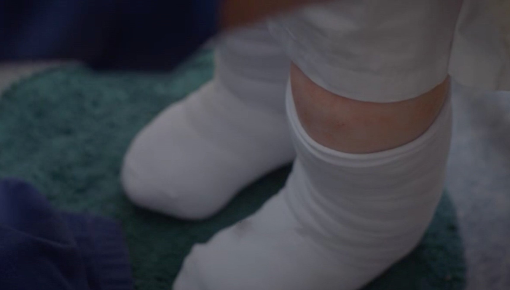 Sister Monica Joan's swollen legs on Call the Midwife