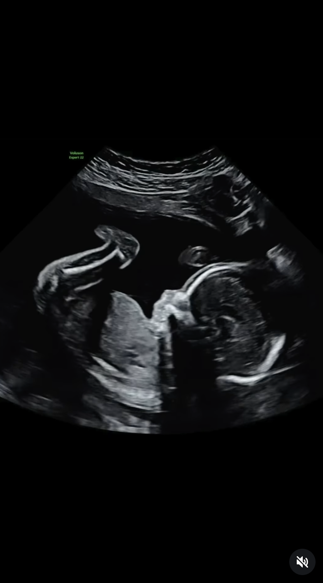 Brook MAFS pregnancy scan