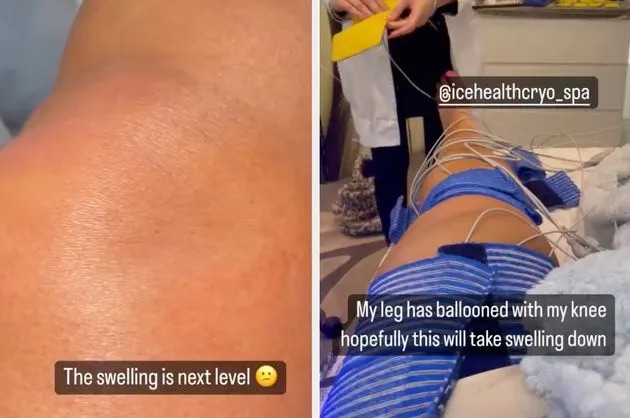 Gemma Collins Instagram Story