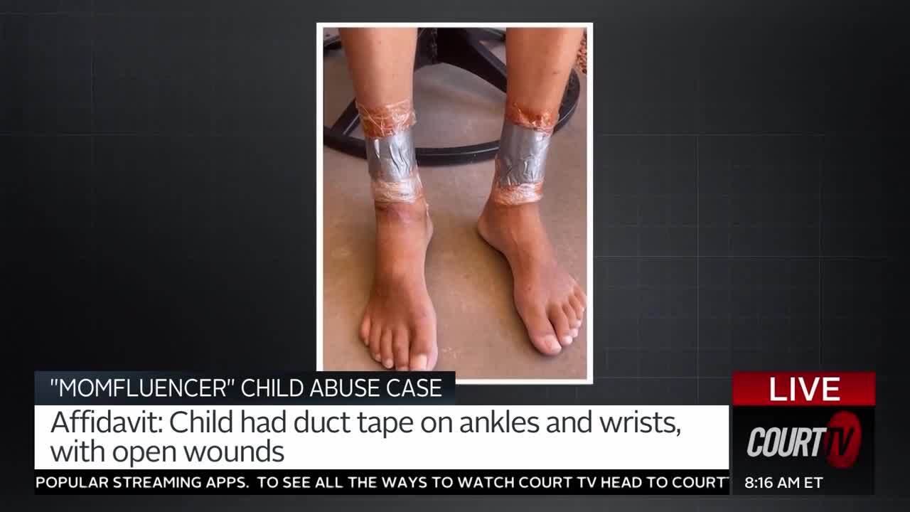 Ruby franke's son injuries