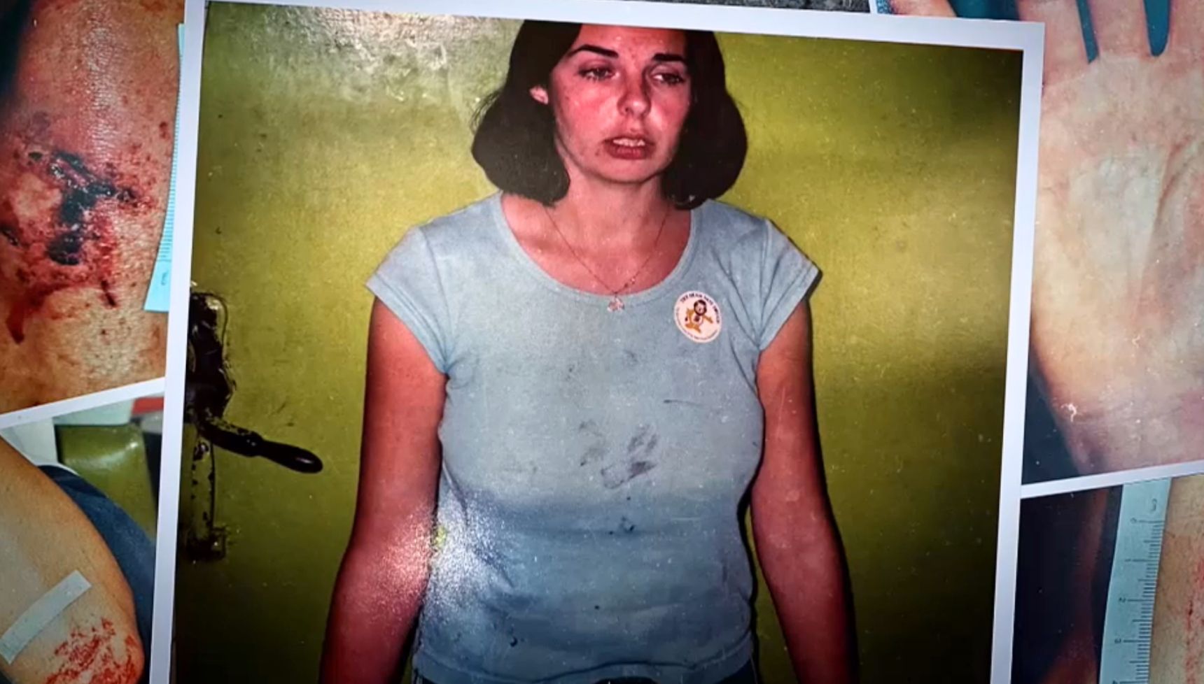 jOANNE lees injuries 