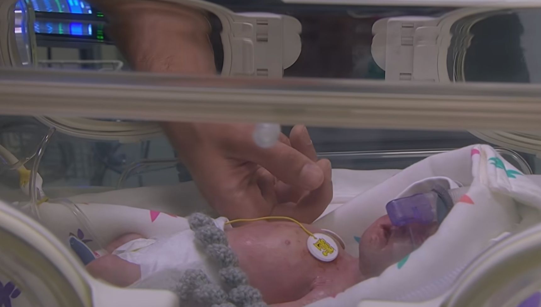 Baby Tate in the hospital in Emmerdale