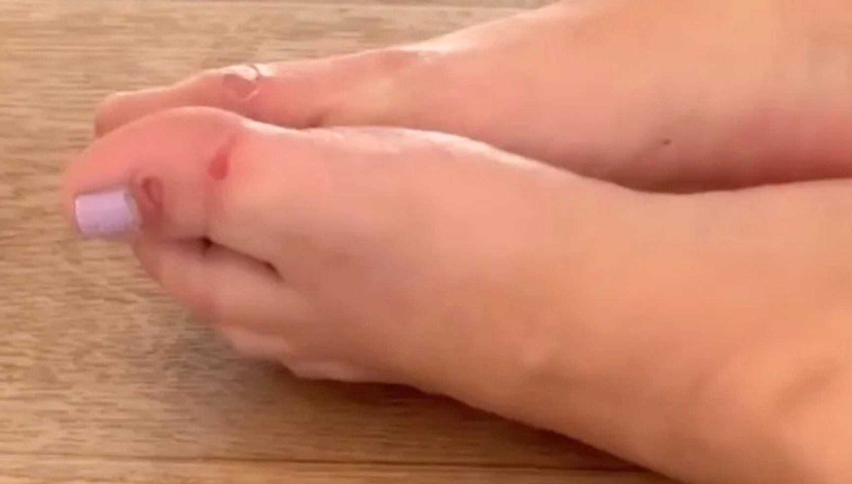 Lacey Turner injured feet